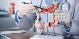 Laparoscopic Colon and Rectal Surgery