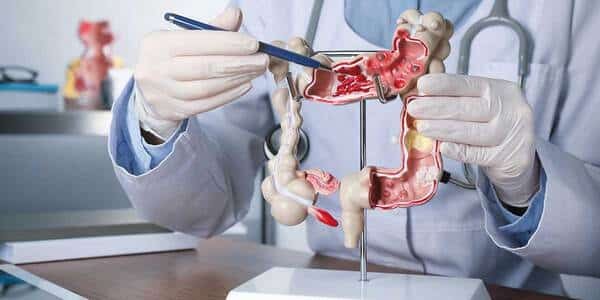Laparoscopic Colon and Rectal Surgery
