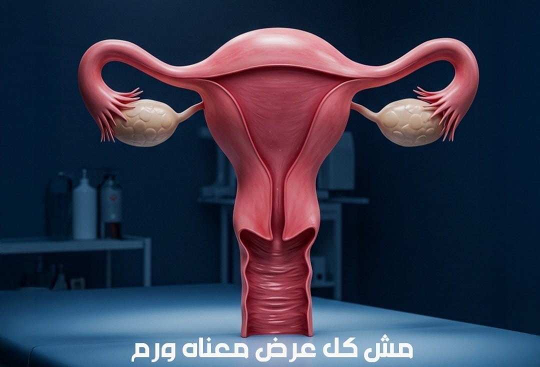 Laparoscopic Uterine and Ovarian Surgery