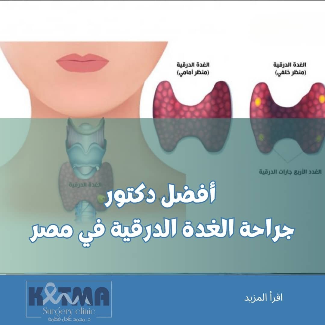 افضل دكتور جراحة الغدة الدرقية في مصر