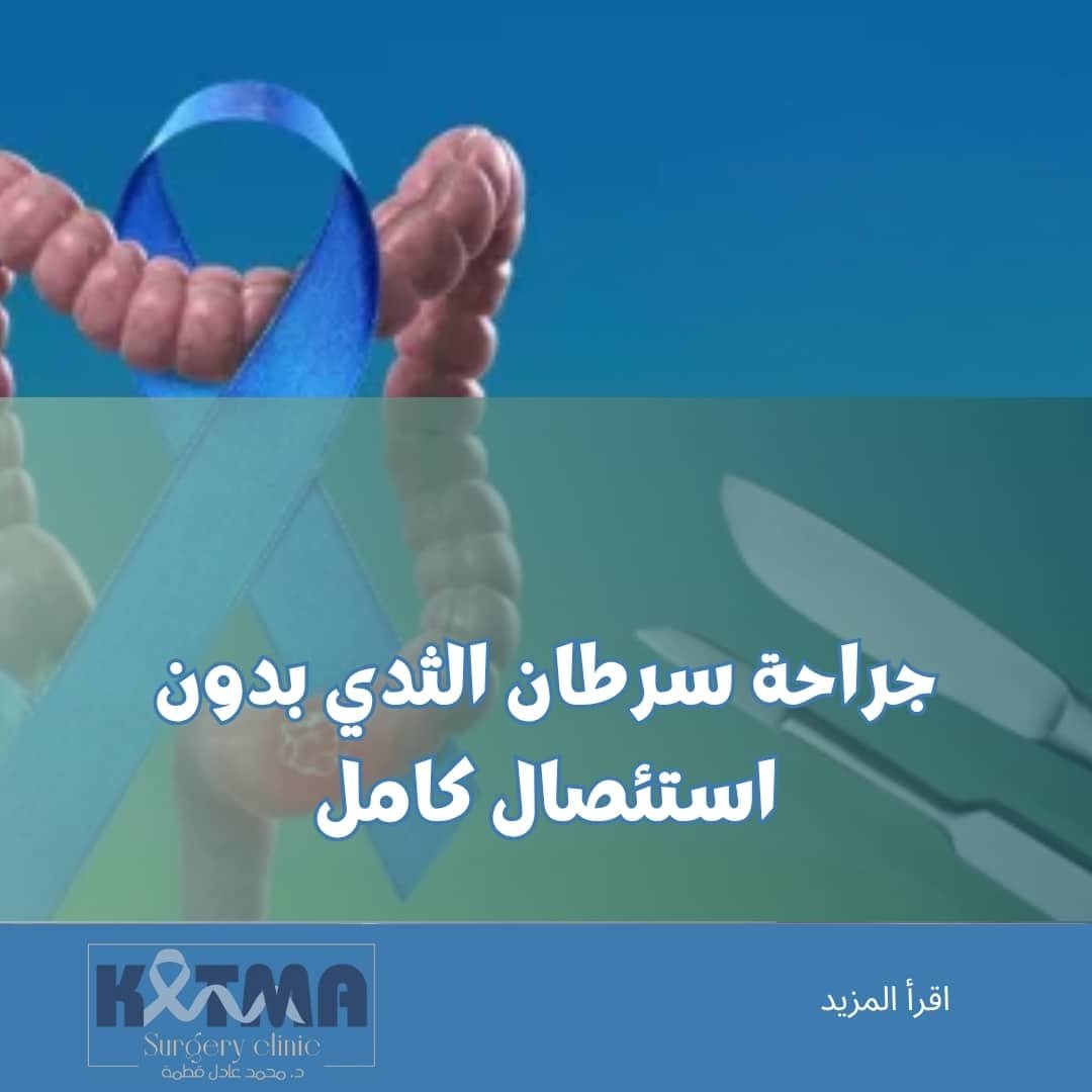 أفضل جراح أورام لاستئصال القولون بالمنظار