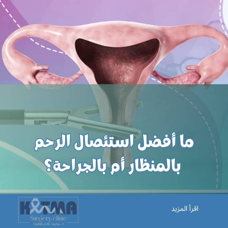 أيهما أفضل استئصال الرحم بالمنظار أم بالجراحة
