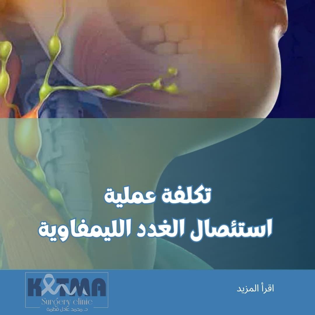 تكلفة عملية استئصال الغدد الليمفاوية