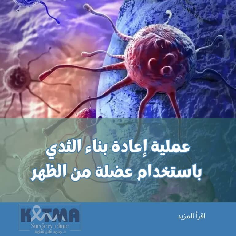 افضل دكتور جراحة اورام في مصر