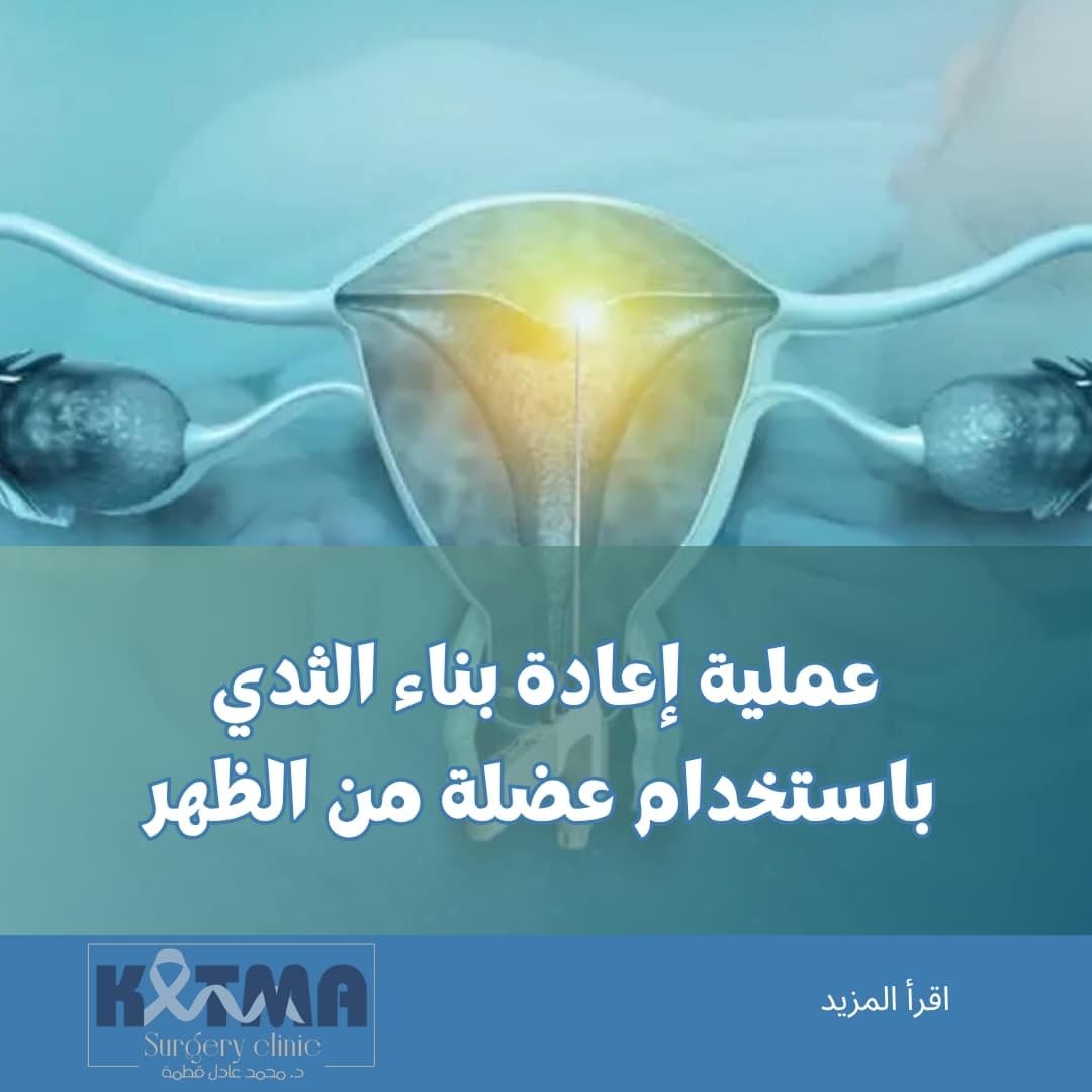 تكلفة عملية استئصال الرحم بالمنظار في مصر