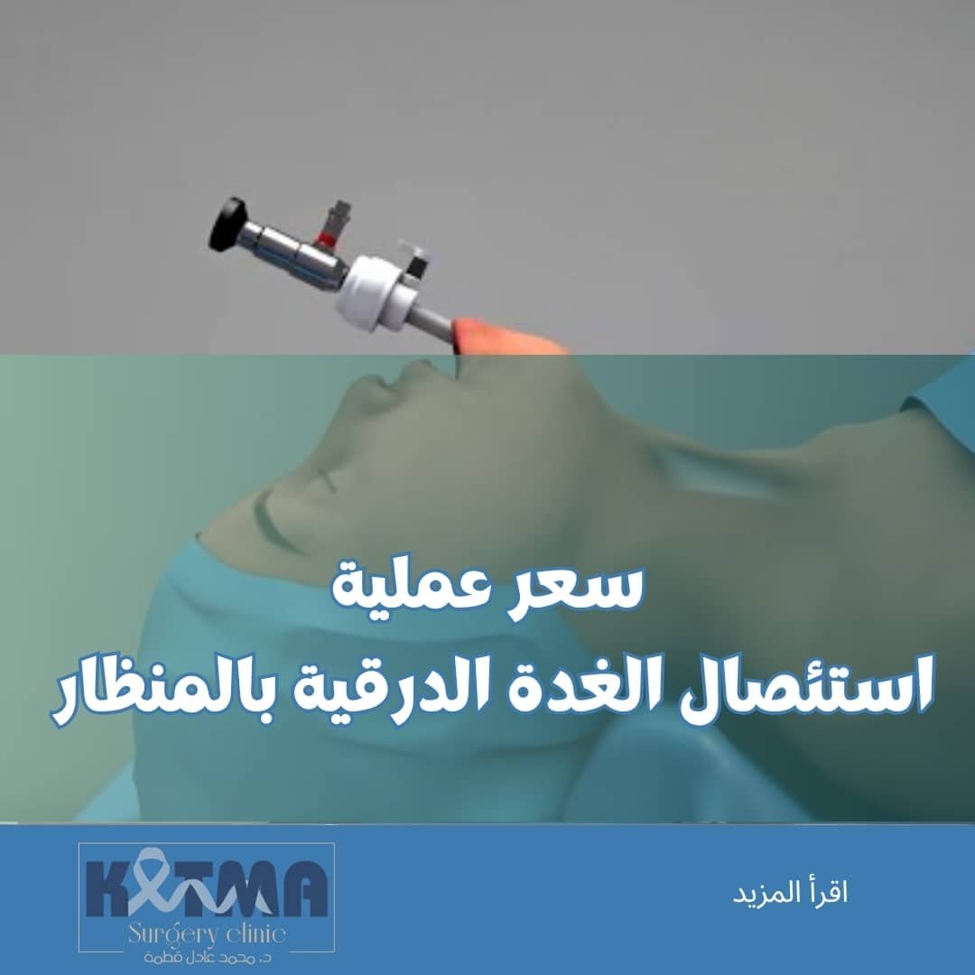 سعر عملية استئصال الغدة الدرقية بالمنظار