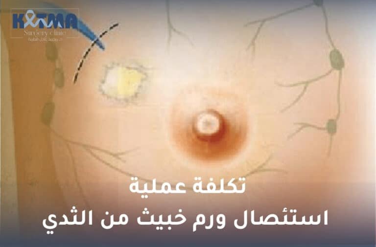 تكلفة عملية استئصال ورم خبيث من الثدي