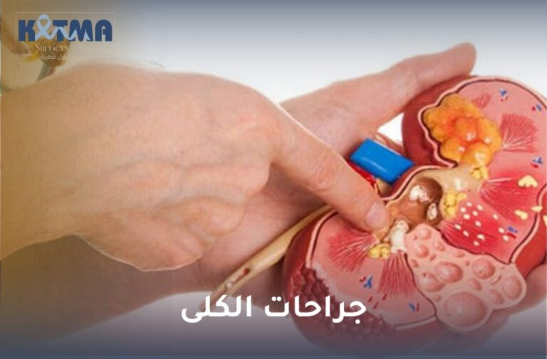 جراحات الكلى
