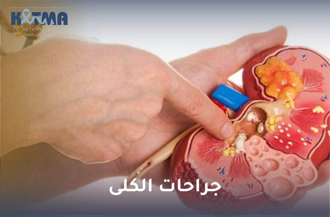 جراحات الكلى