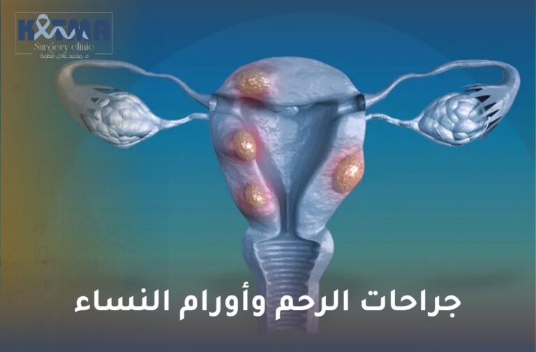 جراحات الرحم وأورام النساء