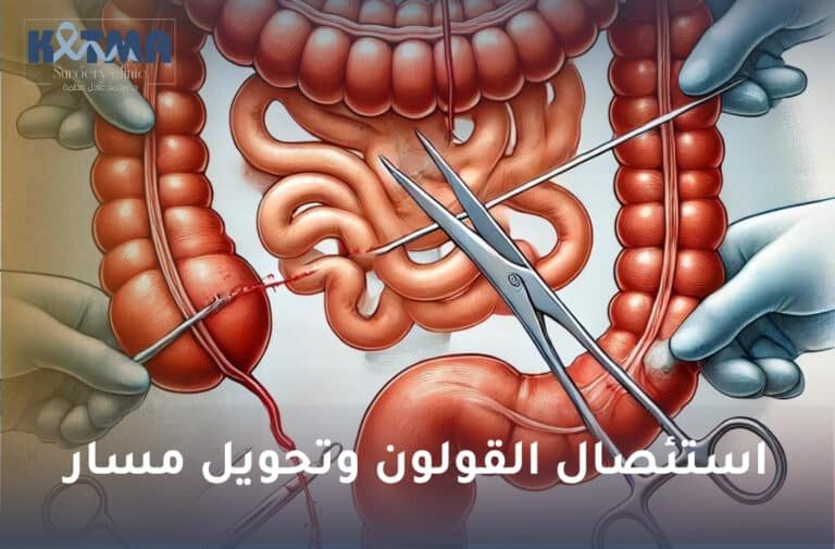 استئصال القولون وتحويل مسار
