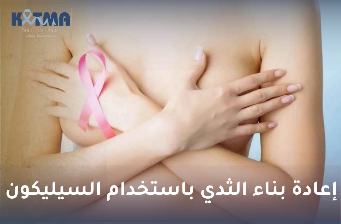 إعادة بناء الثدي باستخدام السيليكون