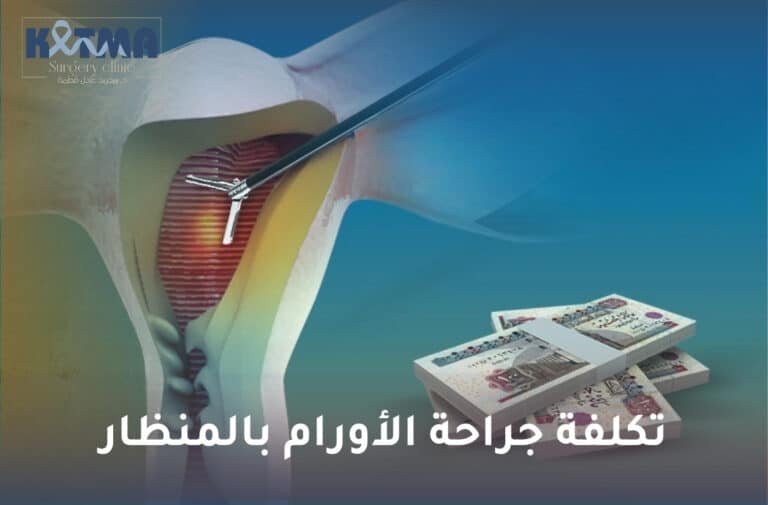 تكلفة جراحة الأورام بالمنظار
