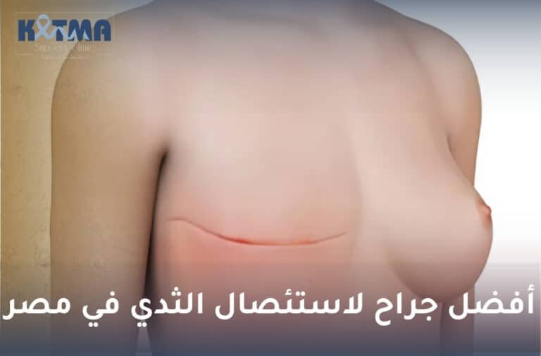 أفضل جراح لاستئصال الثدي في مصر