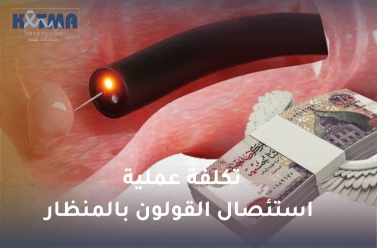 تكلفة عملية استئصال القولون بالمنظار​