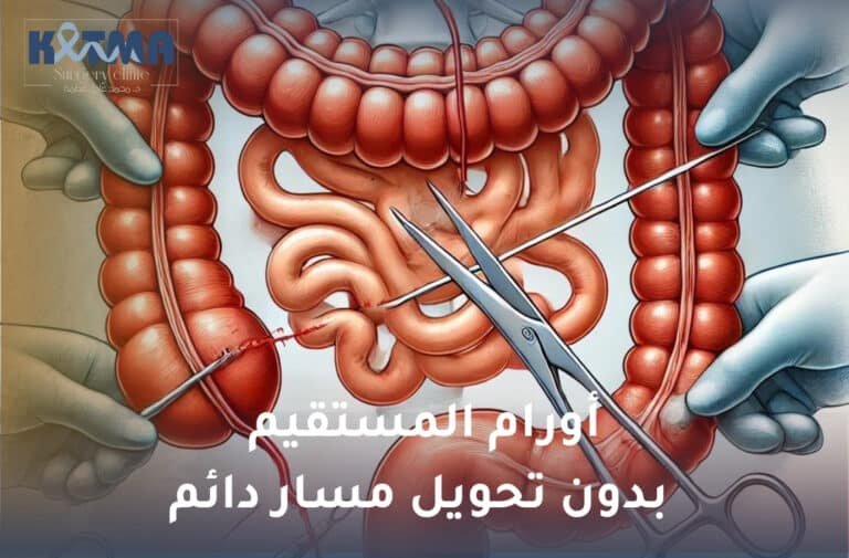 أورام المستقيم بدون تحويل مسار دائم