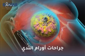 جراحات أورام الثدي