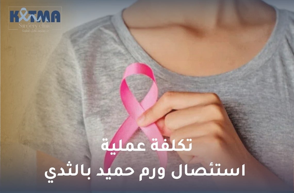 تكلفة عملية استئصال ورم حميد بالثدي