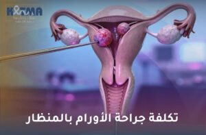 تكلفة جراحة الأورام بالمنظار