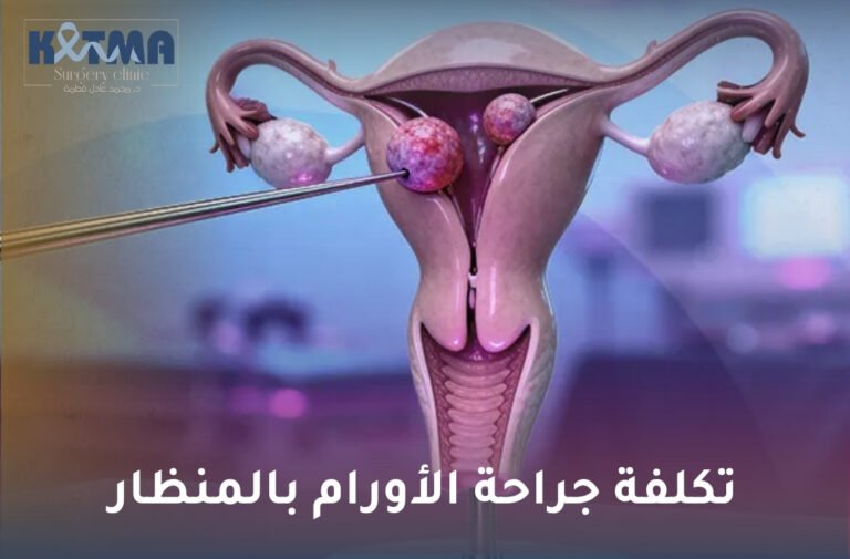 تكلفة جراحة الأورام بالمنظار