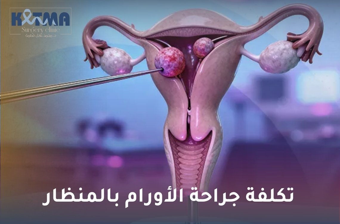 تكلفة جراحة الأورام بالمنظار