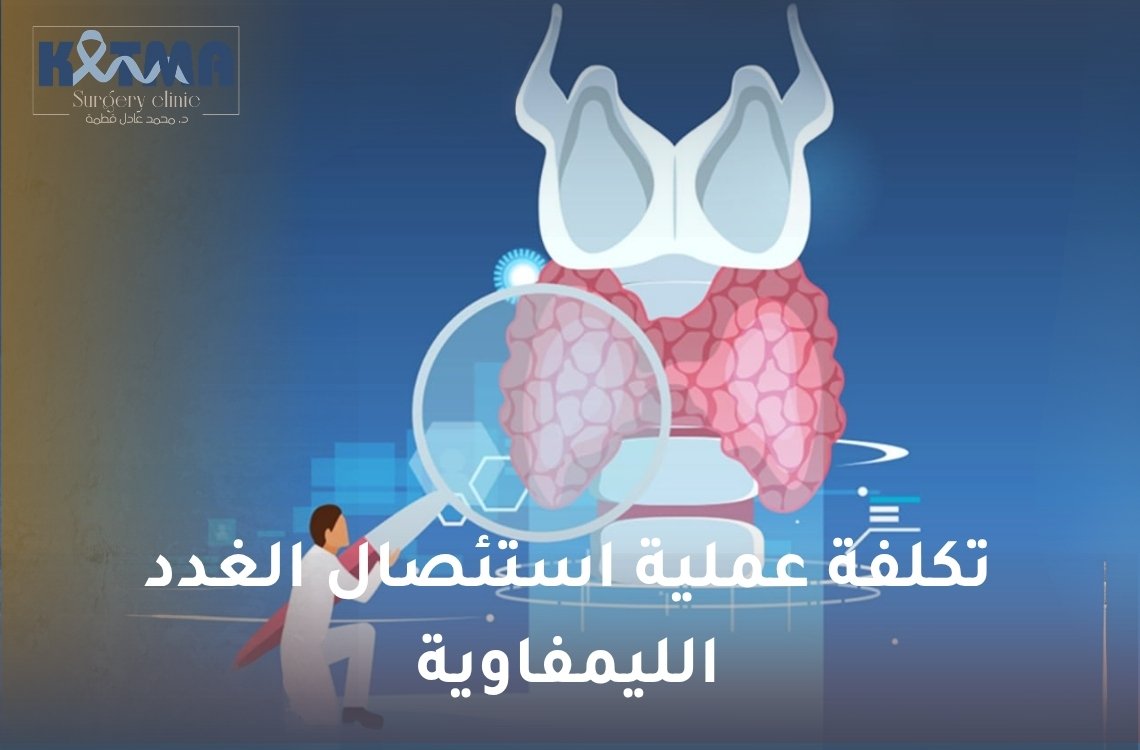 تكلفة عملية استئصال الغدد الليمفاوية