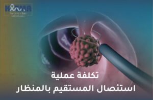 تكلفة عملية استئصال المستقيم بالمنظار