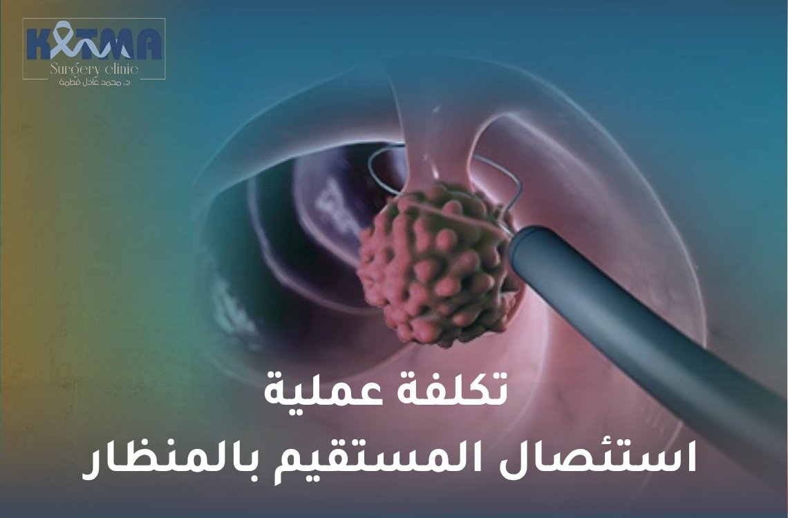 تكلفة عملية استئصال المستقيم بالمنظار