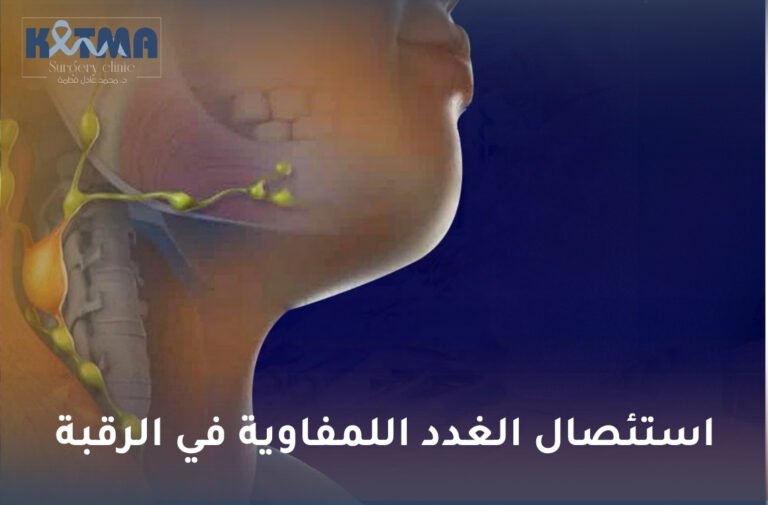 استئصال الغدد اللمفاوية في الرقبة