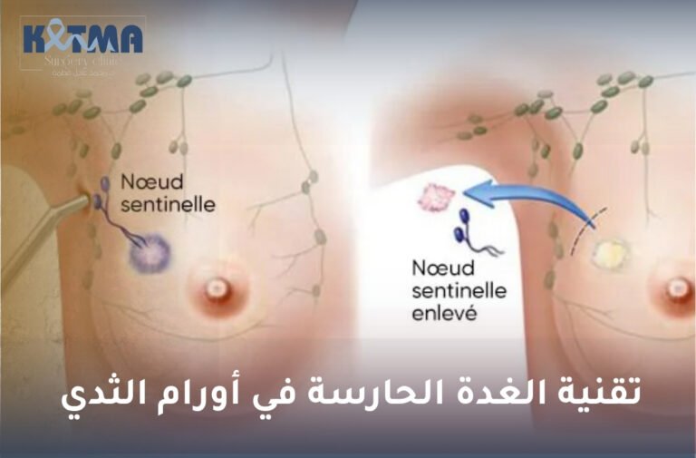 تقنية الغدة الحارسة في أورام الثدي