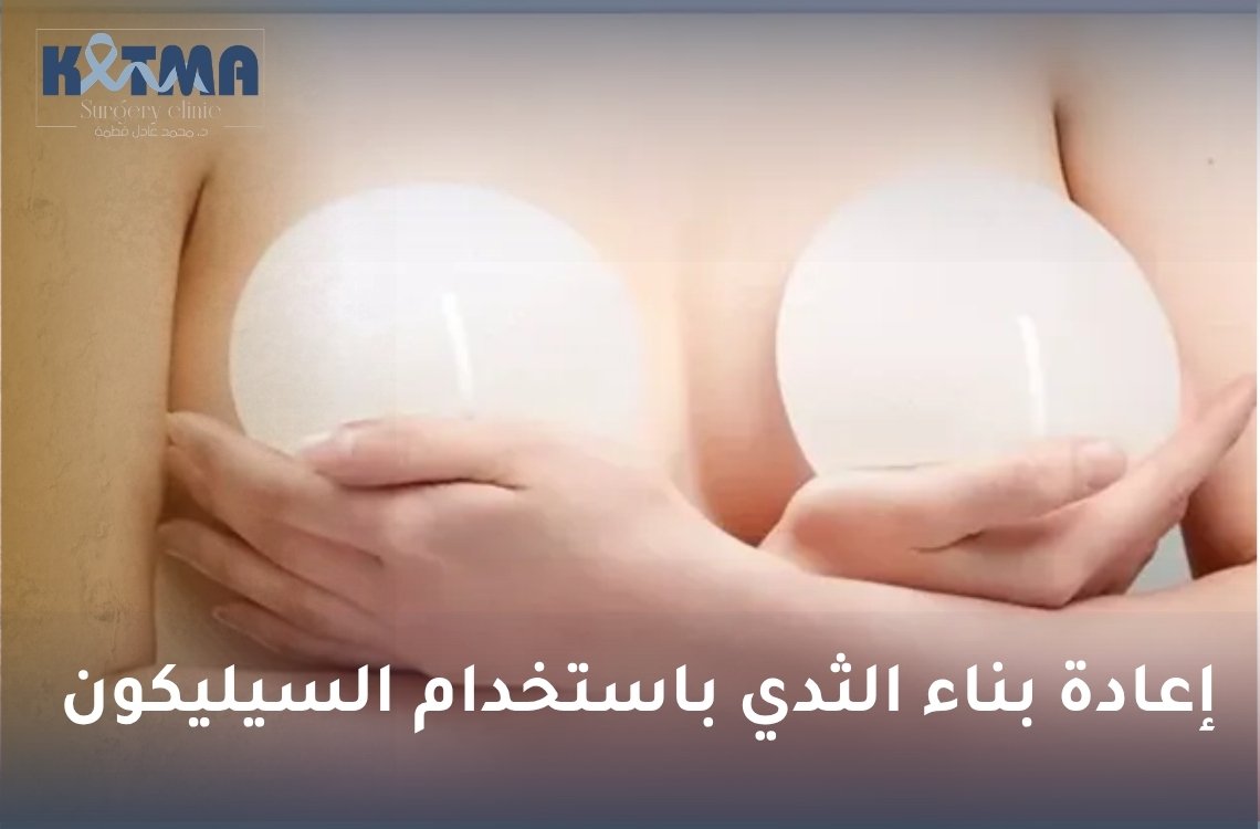 إعادة بناء الثدي باستخدام السيليكون