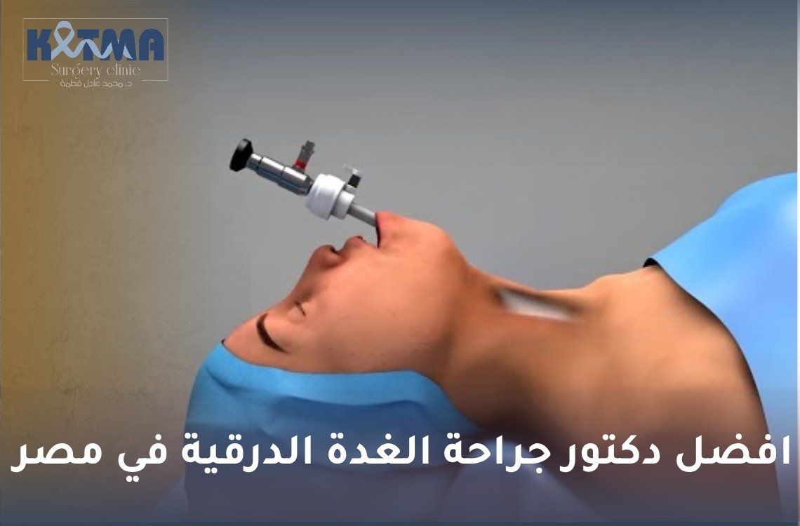 افضل دكتور جراحة الغدة الدرقية في مصر