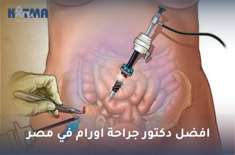 افضل دكتور جراحة اورام في مصر